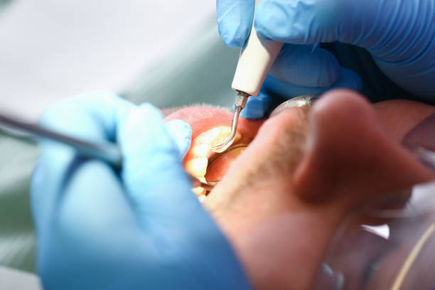 Best Pediatric Emergency Dentist in Deale, MD