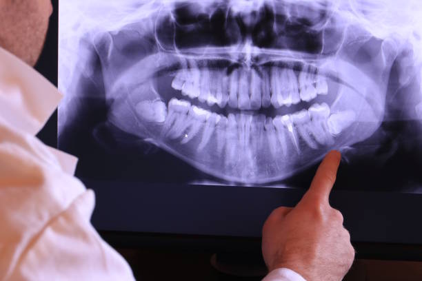 Best Broken or Cracked Tooth Emergency Dentist in Deale, MD